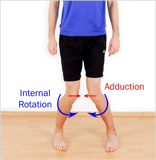 Pictured is an exaggerated example of bad leg alignment. If you do this fast enough on one leg, your ACL may need surgery.